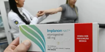 SUS amplia acesso a implante contraceptivo e investe na capacitação de profissionais