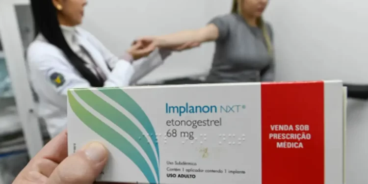 SUS amplia acesso a implante contraceptivo e investe na capacitação de profissionais